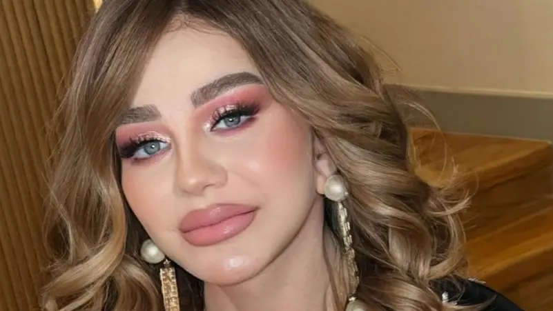 ميادة الحناوي تقلب مواقع التواصل , أطلت بوجه مشدود وشفاه ممتلئة..